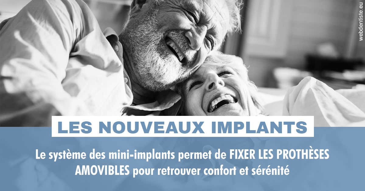 https://dr-santoni-sylvain.chirurgiens-dentistes.fr/Les nouveaux implants 2