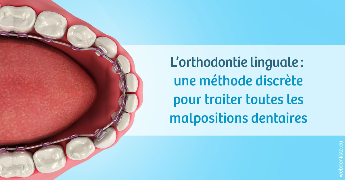 https://dr-santoni-sylvain.chirurgiens-dentistes.fr/L'orthodontie linguale 1