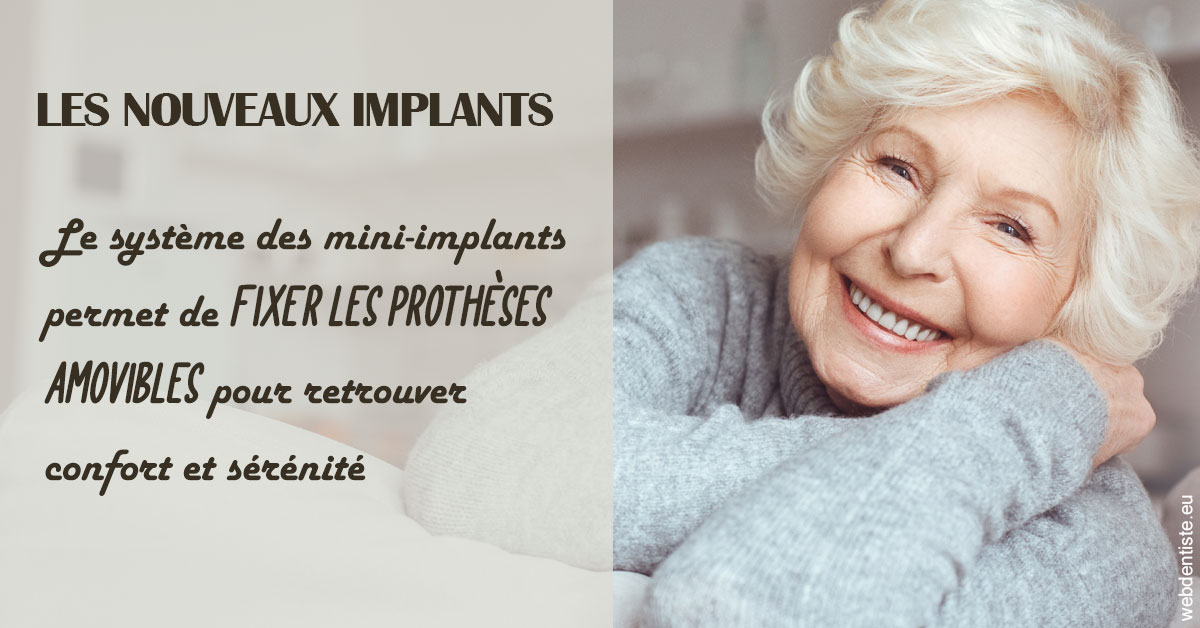 https://dr-santoni-sylvain.chirurgiens-dentistes.fr/Les nouveaux implants 1