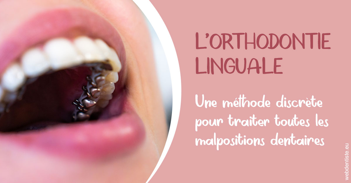 https://dr-santoni-sylvain.chirurgiens-dentistes.fr/L'orthodontie linguale 2