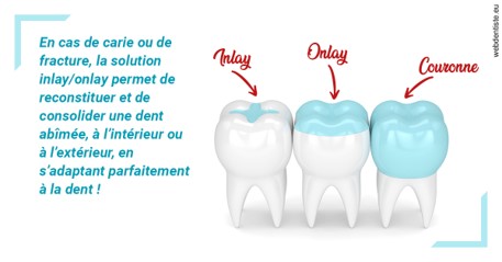 https://dr-santoni-sylvain.chirurgiens-dentistes.fr/L'INLAY ou l'ONLAY