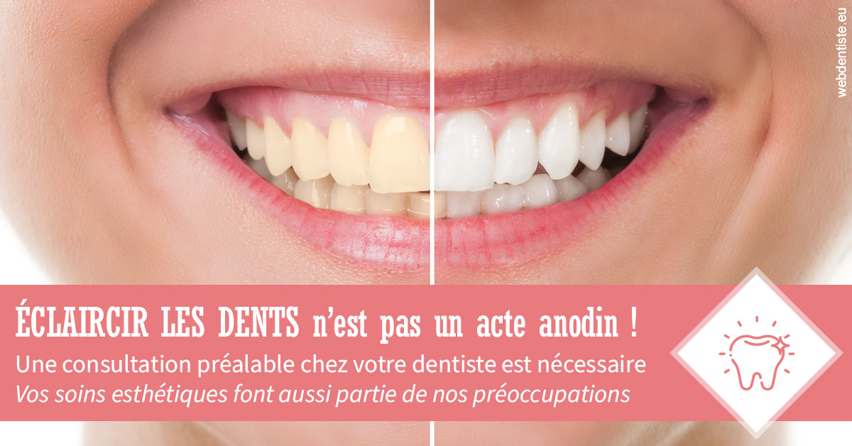 https://dr-santoni-sylvain.chirurgiens-dentistes.fr/Eclaircir les dents 1