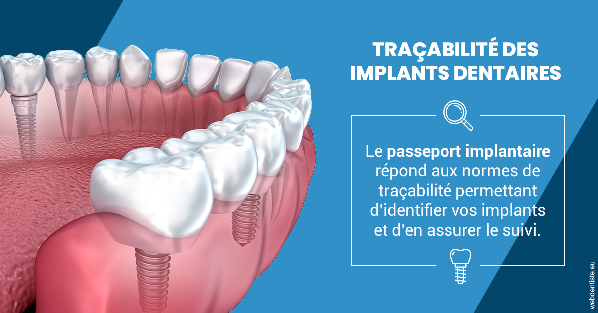 https://dr-santoni-sylvain.chirurgiens-dentistes.fr/T2 2023 - Traçabilité des implants 1