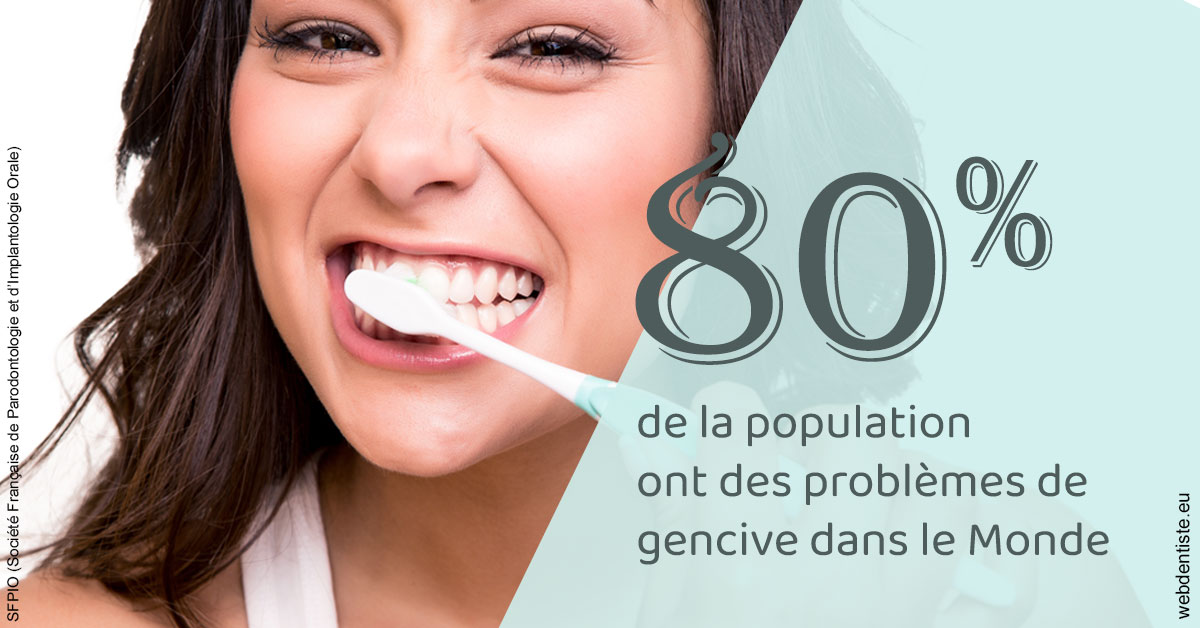 https://dr-santoni-sylvain.chirurgiens-dentistes.fr/Problèmes de gencive 1