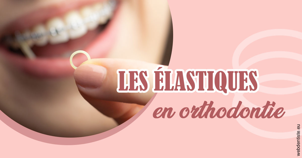 https://dr-santoni-sylvain.chirurgiens-dentistes.fr/Elastiques orthodontie 1