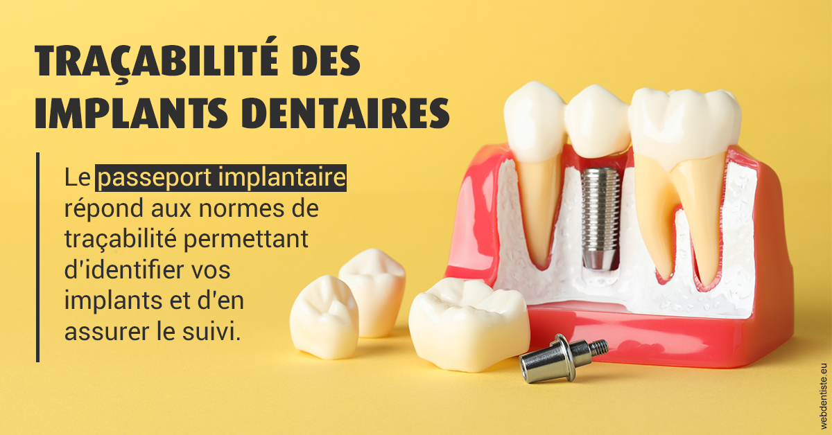 https://dr-santoni-sylvain.chirurgiens-dentistes.fr/T2 2023 - Traçabilité des implants 2