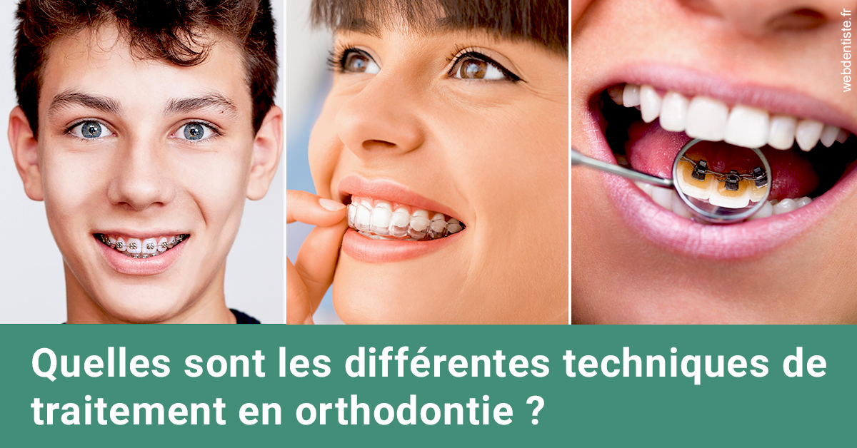 https://dr-santoni-sylvain.chirurgiens-dentistes.fr/Les différentes techniques de traitement 2