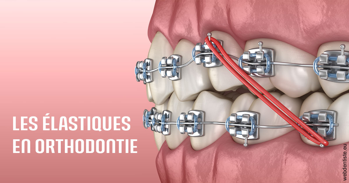 https://dr-santoni-sylvain.chirurgiens-dentistes.fr/Elastiques orthodontie 2