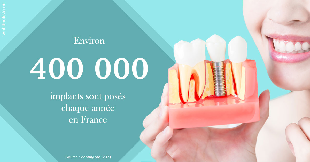 https://dr-santoni-sylvain.chirurgiens-dentistes.fr/Pose d'implants en France 2